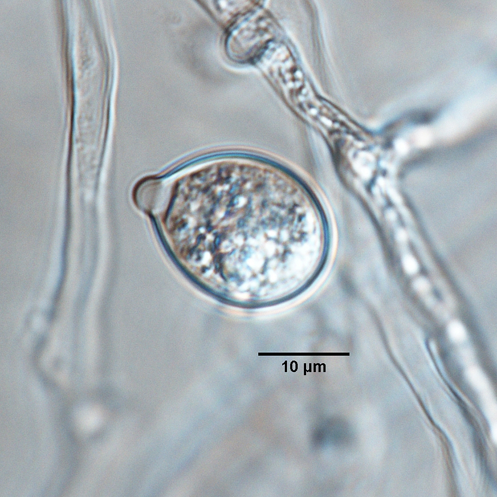   Phytophthora quercetorum  (ex-type CPHST BL 52G) asexual phase: papillate persistent ovoid sporangium originated in unbranched sporangiophore; photo by Gloria Abad, USDA-APHIS-PPQ. 
